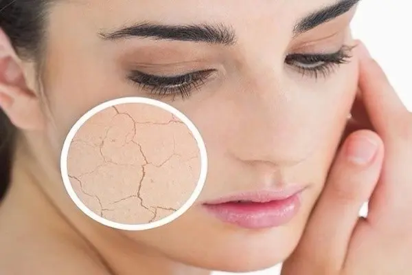 Aesthetic Dry Skin Treatment at Skinsalud.com